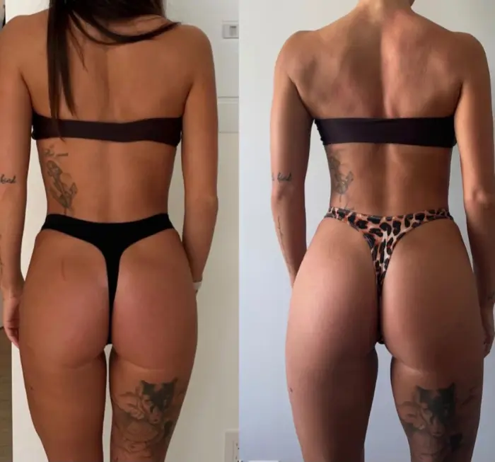 Back Transformation — Dan Calicchia personal training client, Toronto & GTA